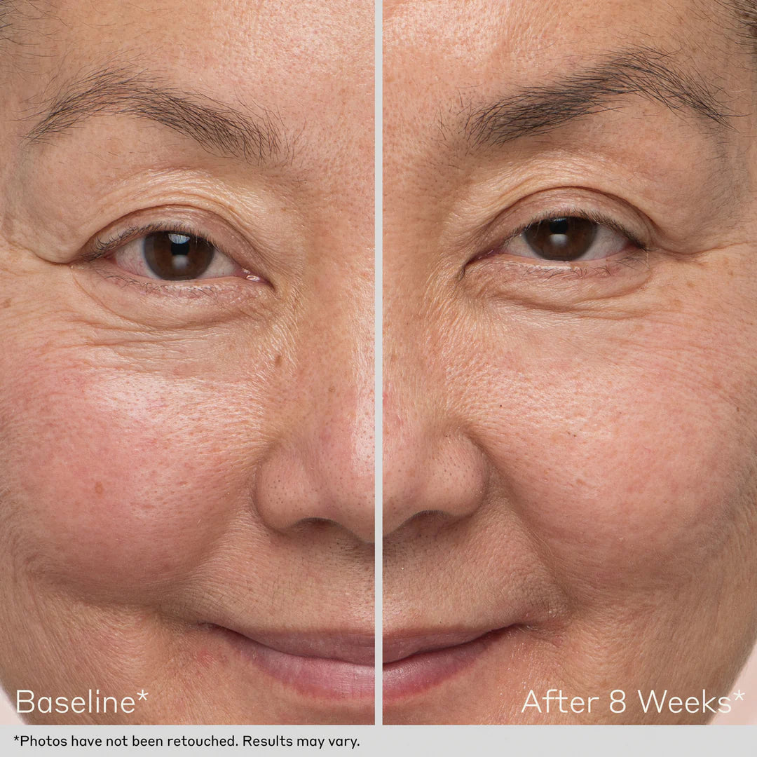 Obagi Nu-Cil Eyebrow Boosting Serum Before and After Results by obagiphilppines.com