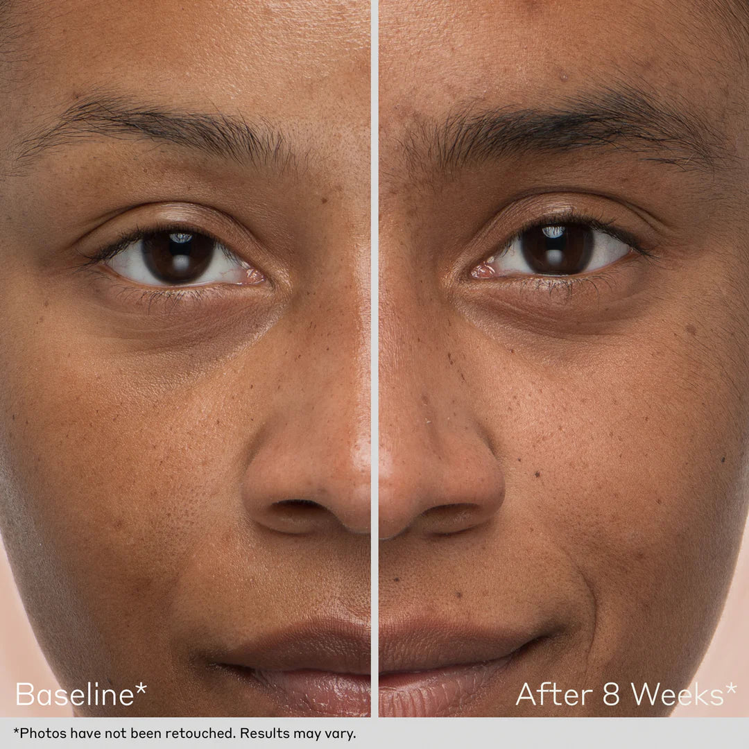 Obagi Nu-Cil Eyebrow Boosting Serum Before and After Results by obagiphilppines.com