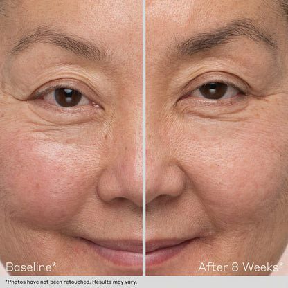 Obagi Nu-Cil Eyebrow Boosting Serum Before and After Results by obagiphilppines.com