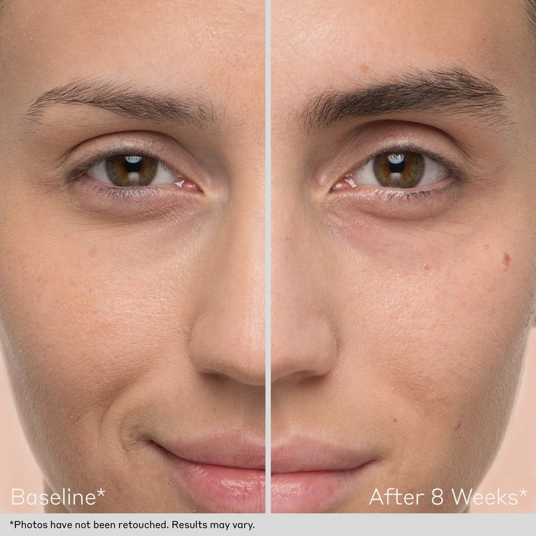 Obagi Nu-Cil Eyebrow Boosting Serum Before and After Results  by obagiphilppines.com